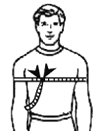 Overarm